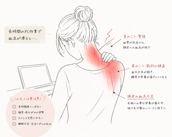 【アダンソン】PCワークと抜け毛の関係について血流と生活習慣から考える